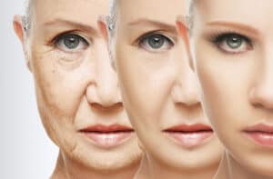 how treat dry face skin