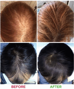 Best hair growth product review