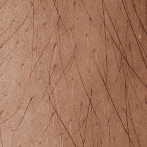 Hair Loss In Females