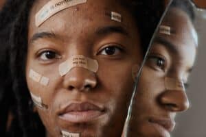 Close-up of a woman’s face with adhesive patches for acne treatment, reflecting Dead Sea cosmetic benefits and natural skincare solutions.